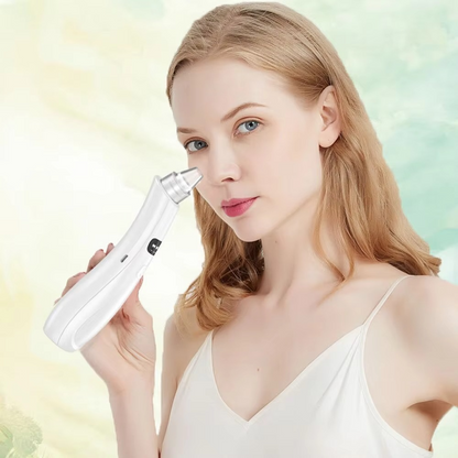 3-Mode Face Cleansing Vacuum – Blackhead Remover & Skin Cleaner ✨💆‍♀️